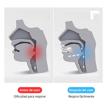 COMFORTMAX™️ Deja de roncar y descansa profundamente